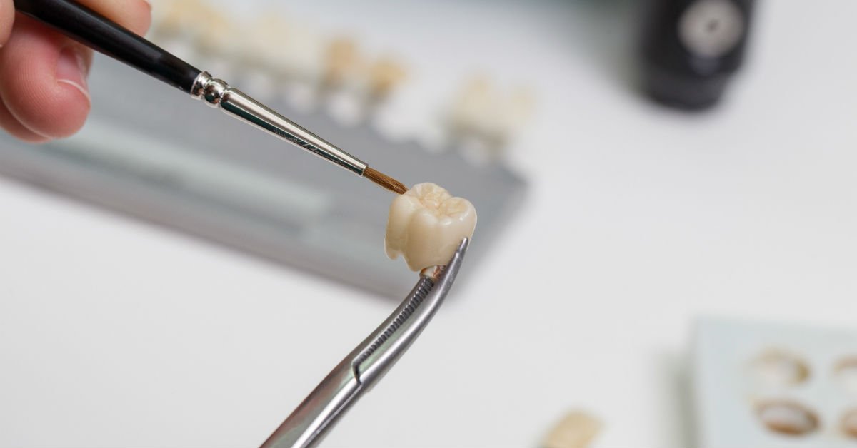 The Problems Associated With Replacing Old or Broken Crowns And How You Can Avoid Them