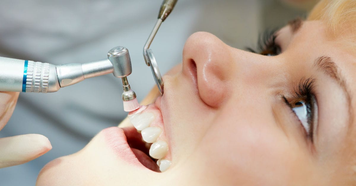 Why Regular Teeth Cleaning is Good For Your Health