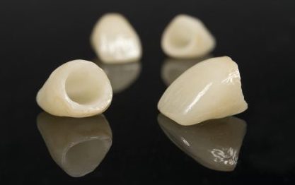 Ceramic-Dental-Crowns