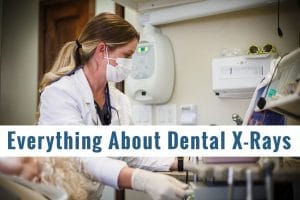 Everything About Dental X-rays (1)