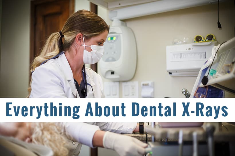 Everything About Dental X-rays