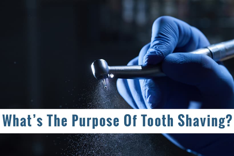 What Is The Purpose Of Tooth Shaving