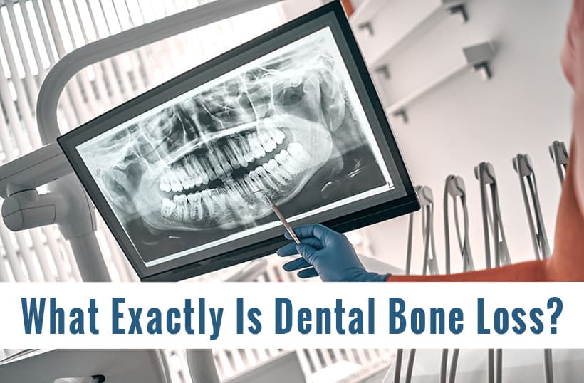 What Is Dental Bone Loss