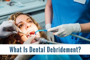 What Is Dental Debridement