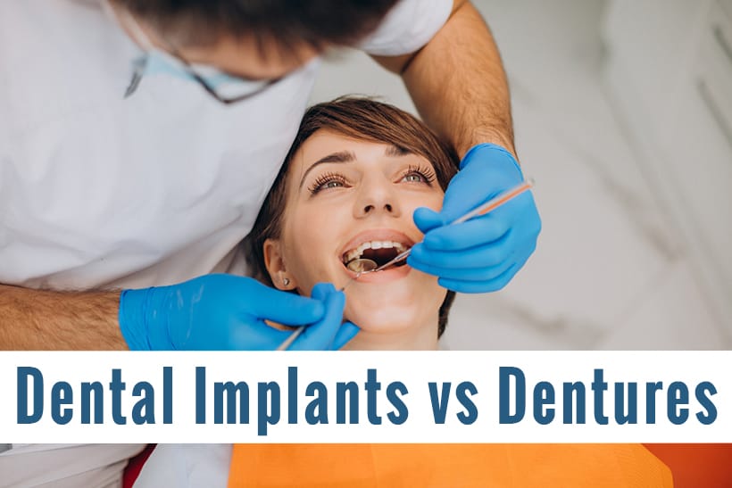 Dental Implants vs Dentures