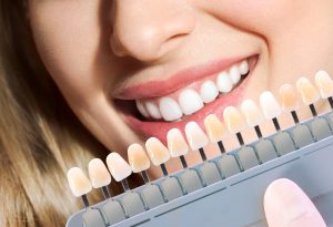 cosmetic dentistry myths