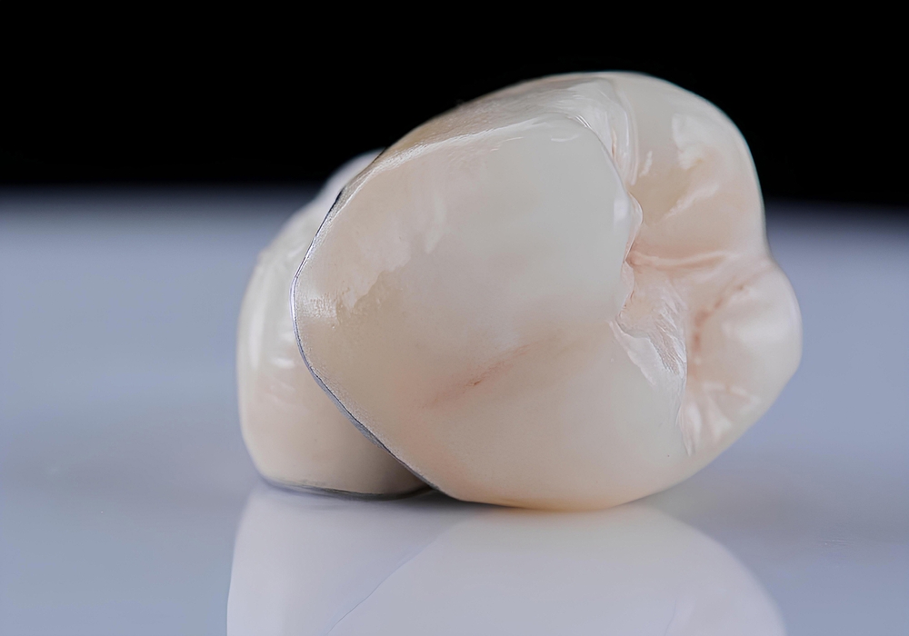 what to do if your dental crown falls off